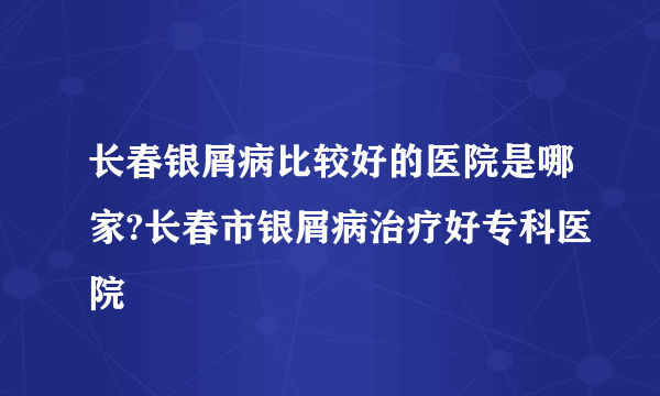 长春银屑病比较好的医院是哪家?长春市银屑病治疗好专科医院