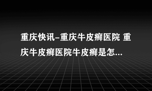 重庆快讯-重庆牛皮癣医院 重庆牛皮癣医院牛皮癣是怎么引起的?