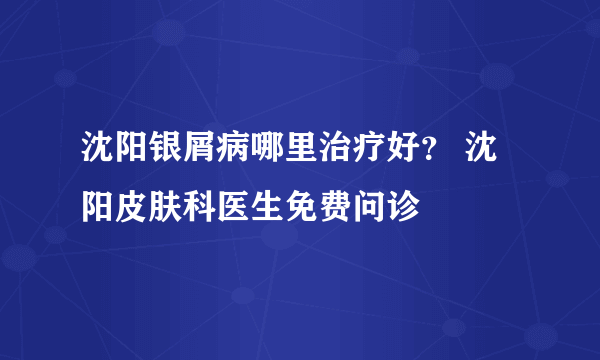 沈阳银屑病哪里治疗好？ 沈阳皮肤科医生免费问诊