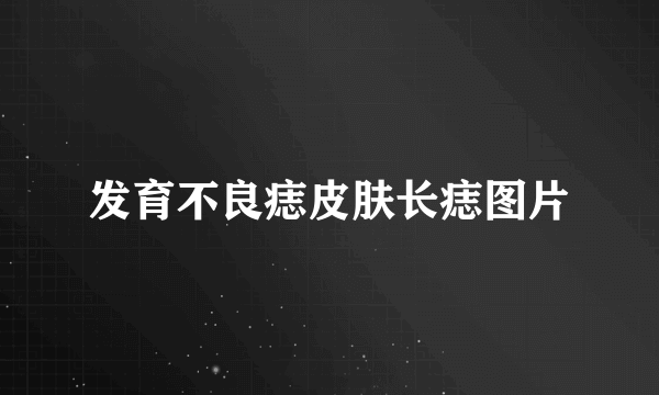 发育不良痣皮肤长痣图片