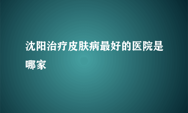 沈阳治疗皮肤病最好的医院是哪家