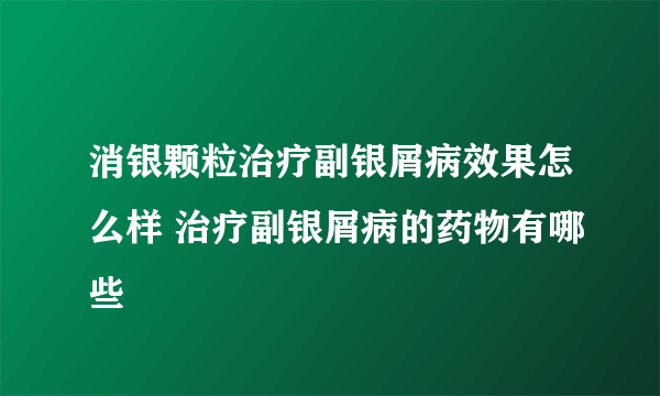 消银颗粒治疗副银屑病效果怎么样 治疗副银屑病的药物有哪些