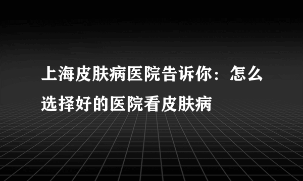 上海皮肤病医院告诉你：怎么选择好的医院看皮肤病