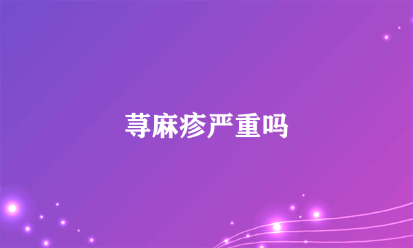 荨麻疹严重吗