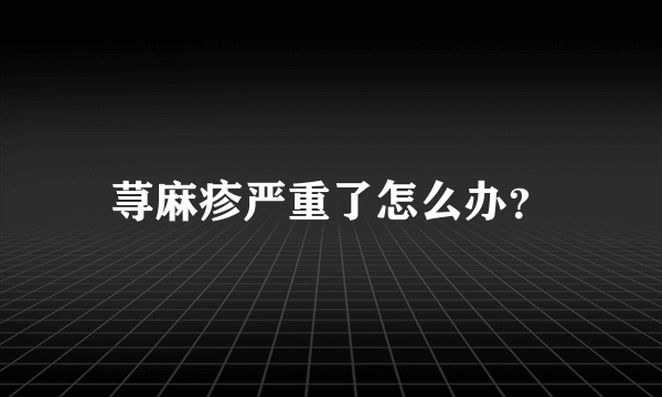 荨麻疹严重了怎么办？