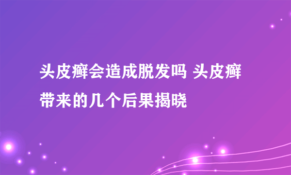 头皮癣会造成脱发吗 头皮癣带来的几个后果揭晓