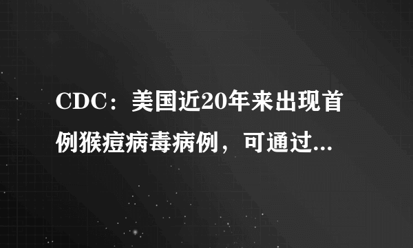 CDC：美国近20年来出现首例猴痘病毒病例，可通过飞沫传播