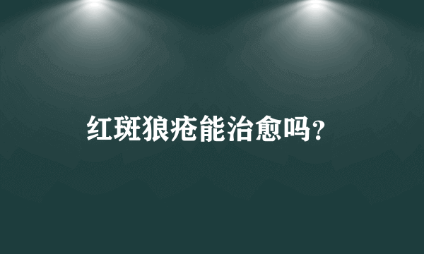 红斑狼疮能治愈吗？