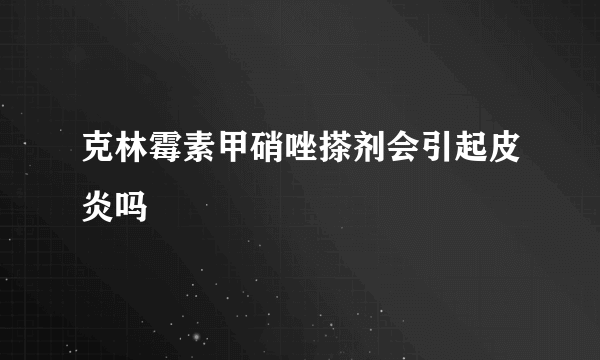 克林霉素甲硝唑搽剂会引起皮炎吗