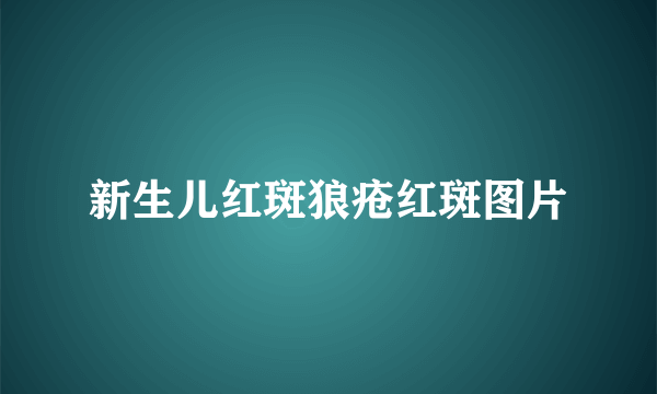 新生儿红斑狼疮红斑图片