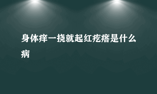 身体痒一挠就起红疙瘩是什么病