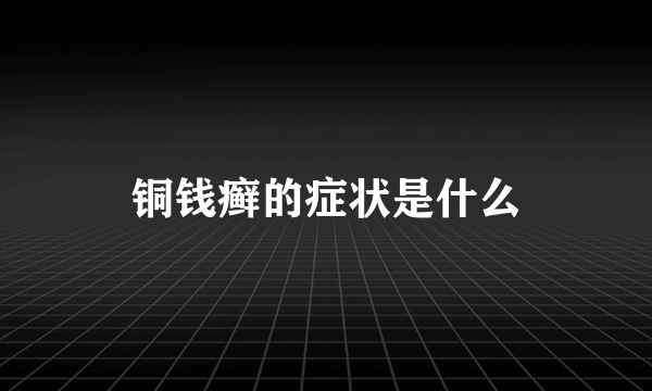 铜钱癣的症状是什么