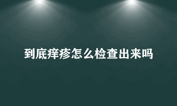 到底痒疹怎么检查出来吗