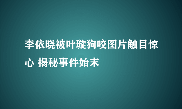 李依晓被叶璇狗咬图片触目惊心 揭秘事件始末