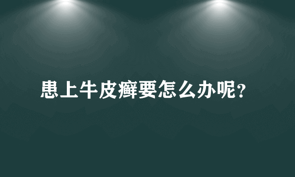 患上牛皮癣要怎么办呢？