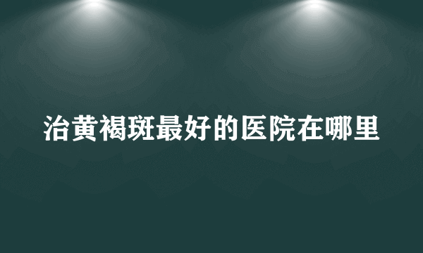 治黄褐斑最好的医院在哪里