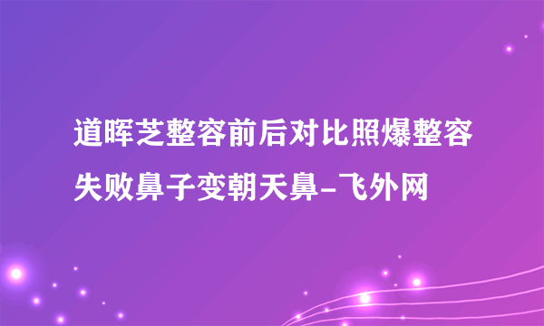 道晖芝整容前后对比照爆整容失败鼻子变朝天鼻-飞外网