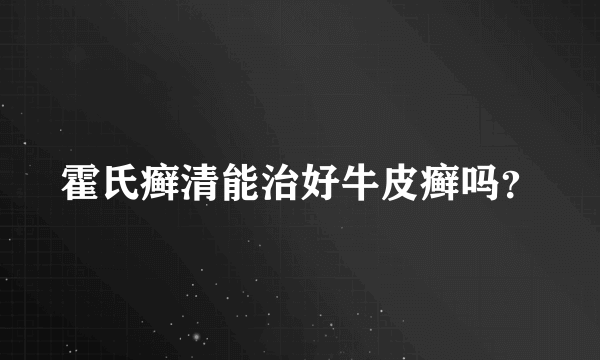 霍氏癣清能治好牛皮癣吗？