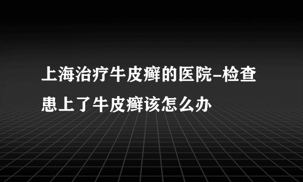 上海治疗牛皮癣的医院-检查患上了牛皮癣该怎么办