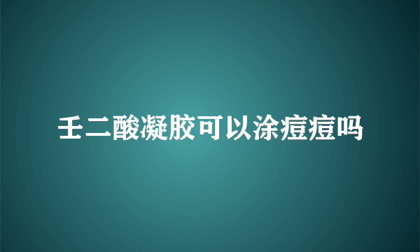 壬二酸凝胶可以涂痘痘吗