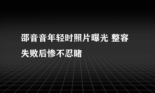 邵音音年轻时照片曝光 整容失败后惨不忍睹