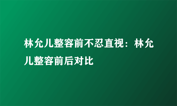 林允儿整容前不忍直视：林允儿整容前后对比