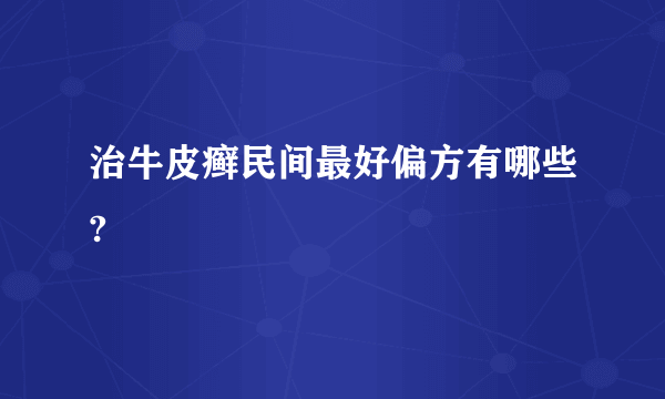 治牛皮癣民间最好偏方有哪些?