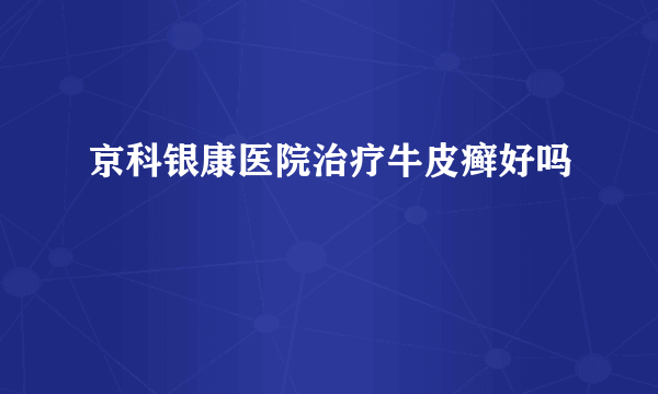 京科银康医院治疗牛皮癣好吗