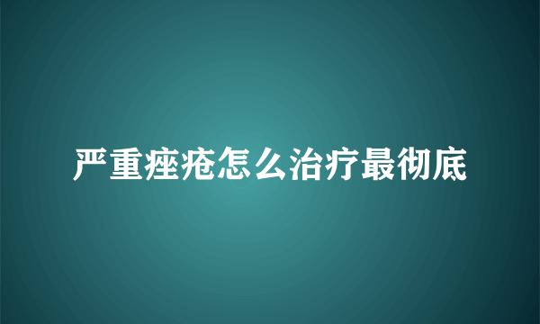 严重痤疮怎么治疗最彻底