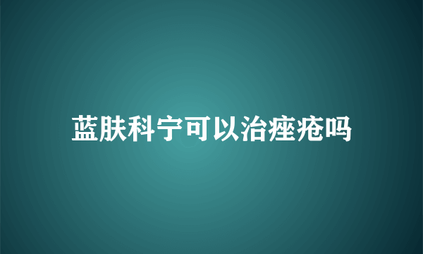 蓝肤科宁可以治痤疮吗