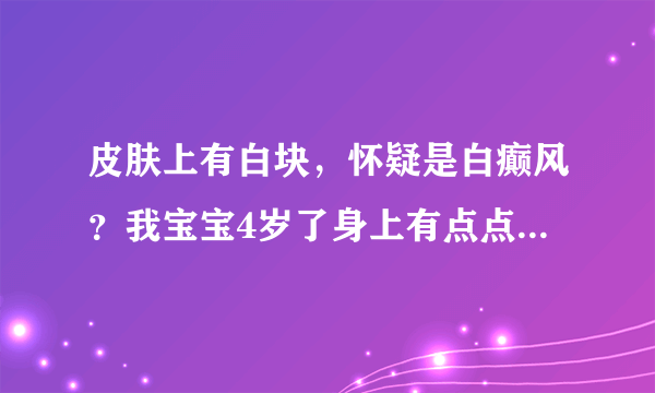 皮肤上有白块，怀疑是白癫风？我宝宝4岁了身上有点点白...