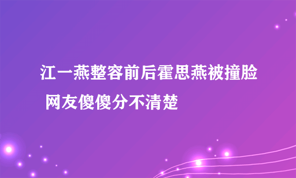 江一燕整容前后霍思燕被撞脸 网友傻傻分不清楚