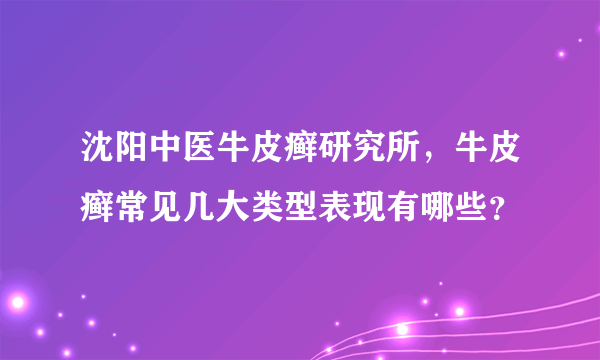 沈阳中医牛皮癣研究所，牛皮癣常见几大类型表现有哪些？