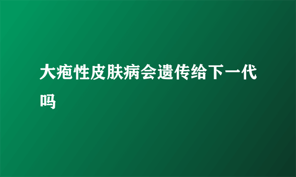 大疱性皮肤病会遗传给下一代吗