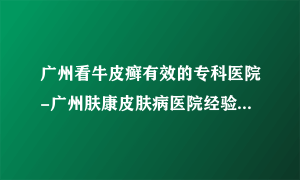 广州看牛皮癣有效的专科医院-广州肤康皮肤病医院经验丰富，服务优质