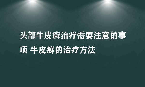 头部牛皮癣治疗需要注意的事项 牛皮癣的治疗方法