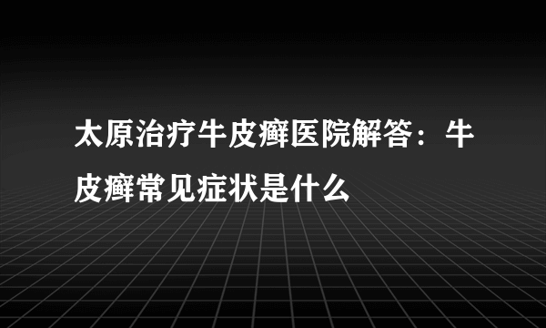 太原治疗牛皮癣医院解答：牛皮癣常见症状是什么