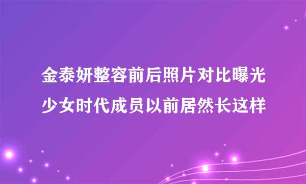 金泰妍整容前后照片对比曝光少女时代成员以前居然长这样