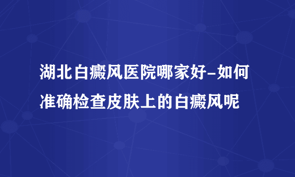 湖北白癜风医院哪家好-如何准确检查皮肤上的白癜风呢