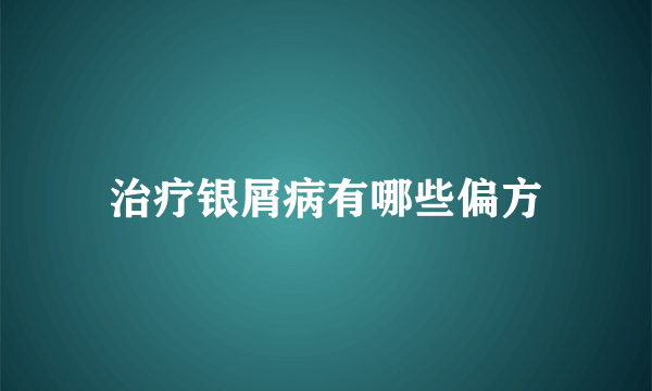 治疗银屑病有哪些偏方