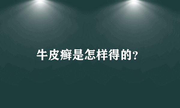 牛皮癣是怎样得的？