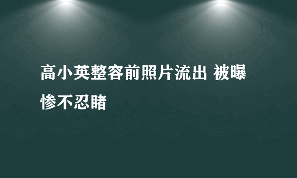 高小英整容前照片流出 被曝惨不忍睹