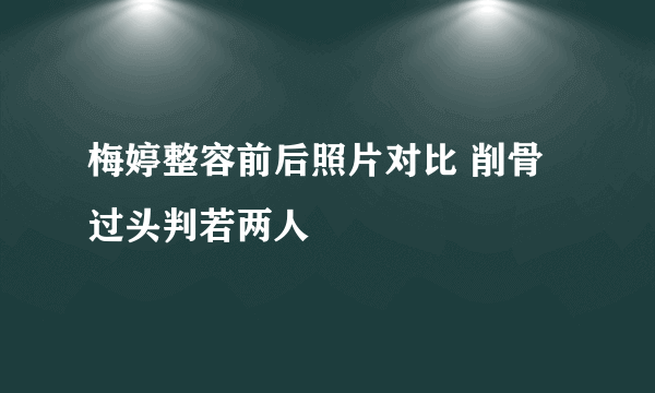 梅婷整容前后照片对比 削骨过头判若两人