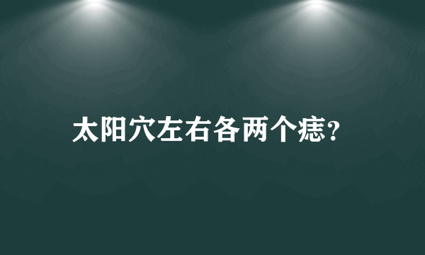 太阳穴左右各两个痣？