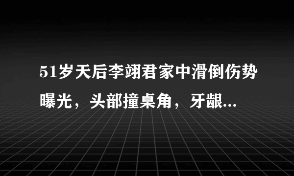 51岁天后李翊君家中滑倒伤势曝光，头部撞桌角，牙龈出血右脸淤青