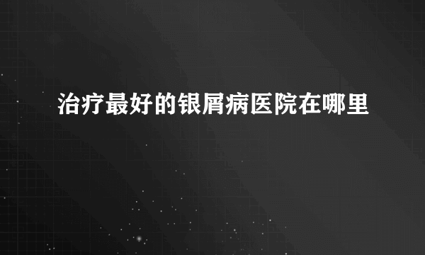 治疗最好的银屑病医院在哪里