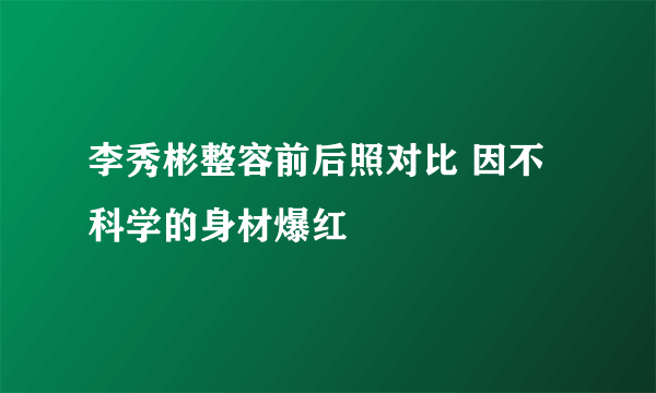 李秀彬整容前后照对比 因不科学的身材爆红