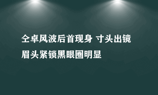 仝卓风波后首现身 寸头出镜眉头紧锁黑眼圈明显