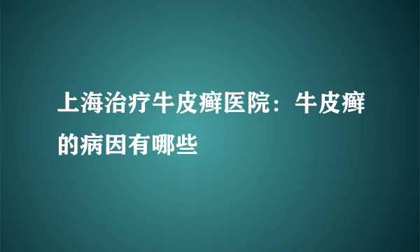 上海治疗牛皮癣医院：牛皮癣的病因有哪些