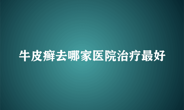 牛皮癣去哪家医院治疗最好